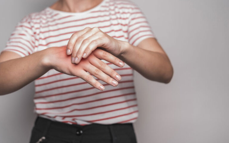 Tendinite de Quervain