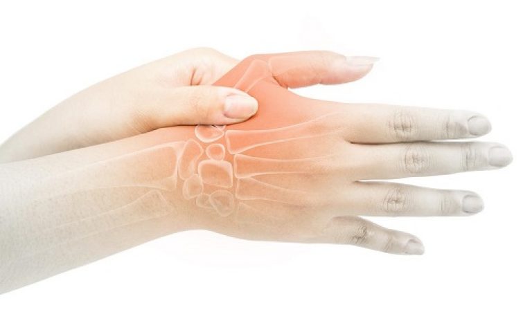 Rhizarthrose ou arthrose du pouce