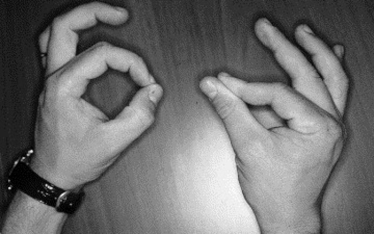 Le syndrome des nerfs interosseux