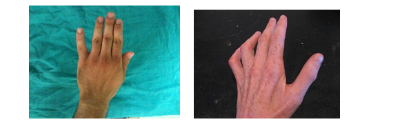 Image module
