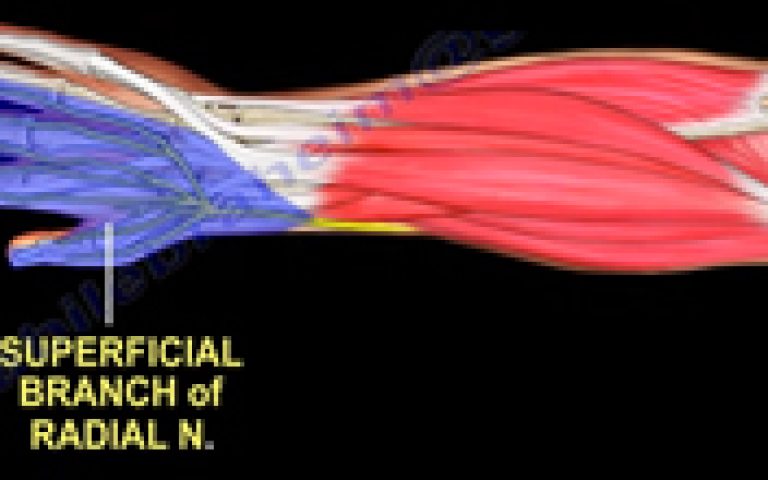 Cheiralgie paresthésique ou maladie de Wartenberg