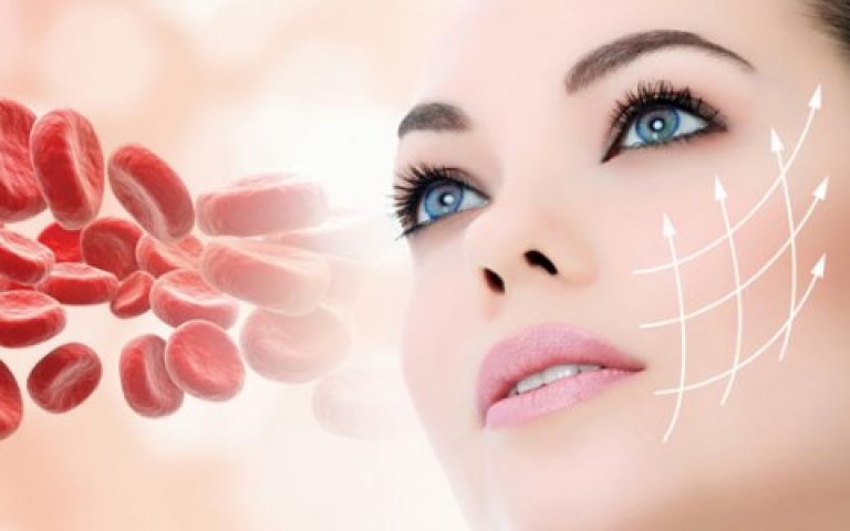 Plasma Riche en Plaquettes (PRP)